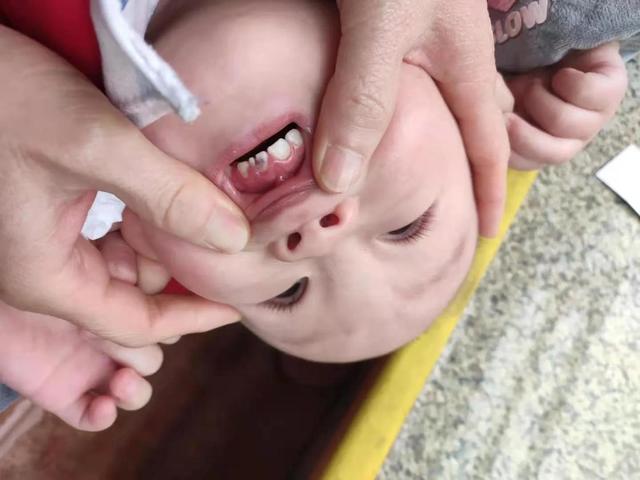 小班宝宝总是磨牙怎么办